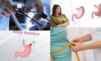 Mide Ameliyatı Sonrası Günlük Yaşama Nasıl Dönülür?